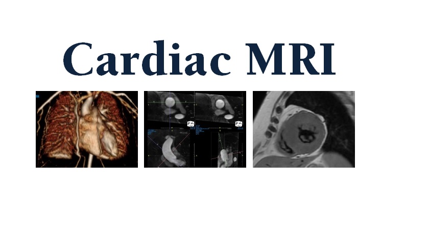 Cardiac MRI